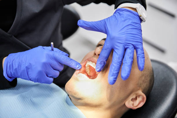Best Emergency Dental Care for Broken or Chipped Teeth in Gresham Park, GA