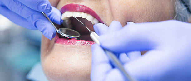 Best Emergency Treatment for Dental Infections or Abscesses in Gresham Park, GA